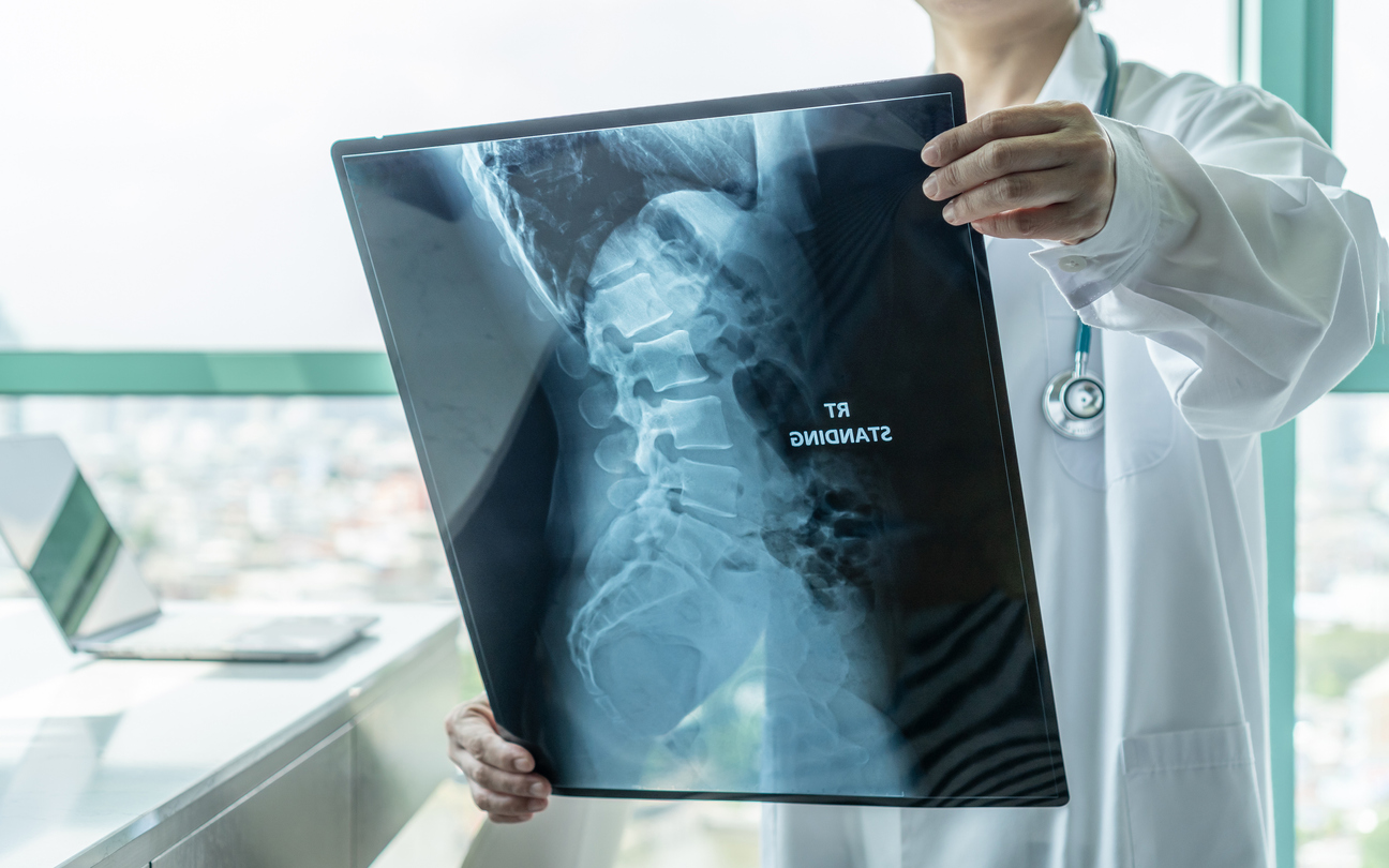 What Are the Symptoms of a Broken Tailbone?